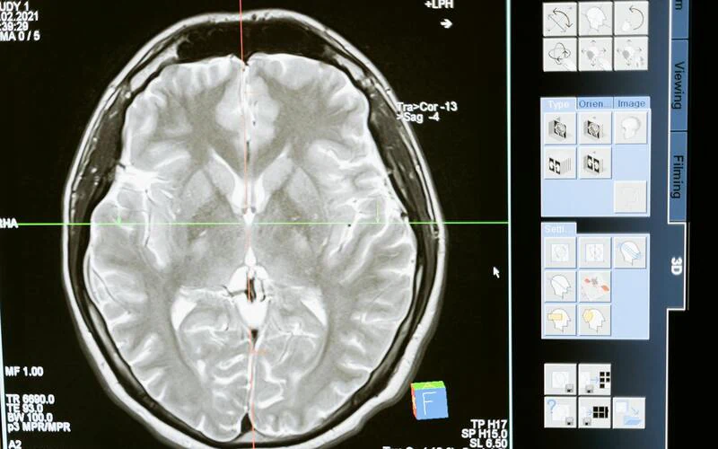 Three years of AI deployment in hospital radiology